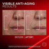 Revitalift Laser Renew Night Cream — clinically proven before and after skin results