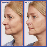 L'Oréal Paris Pure Retinol Serum — dermatologist validated anti-wrinkle results